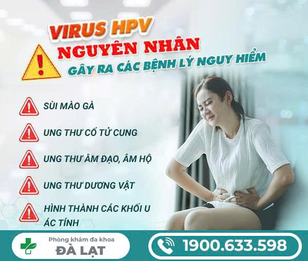 Hình ảnh minh họa